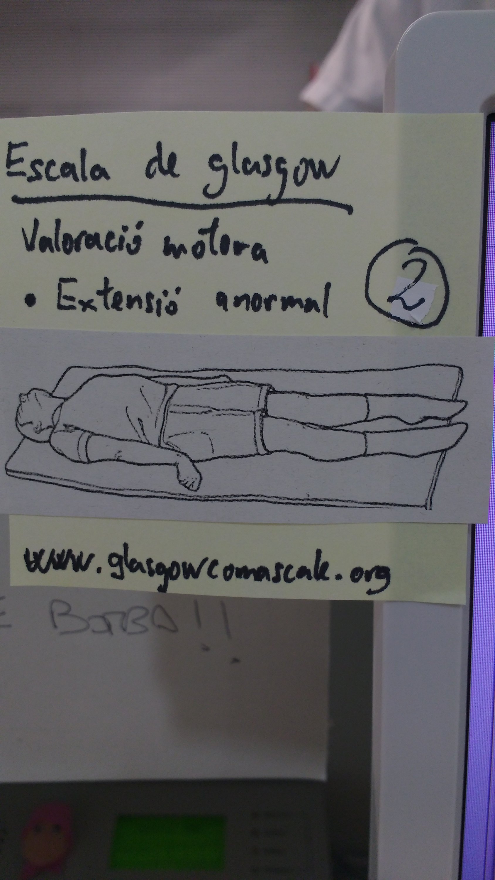 Post-It groc enganxat en una pantalla d'ordinador. El contingut del Post-It és:
(títol) Escala de Glasgow
Valoració motora
Extensió anormal (2 punts)

Hi ha enganxat un diagrama d'una persona estirada en extensió de cames, els braços ben extensionats pel colze, al costat del cos, en rotació interna d'espatlla i amb els canells també en flexió

Finalment es mostra l'adreça web www.glasgowcomascale.org