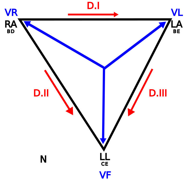 Electrocardiogrames mal fets I: Inversió de derivacions d’extremitats